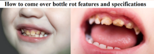 How to come over bottle rot features and specifications